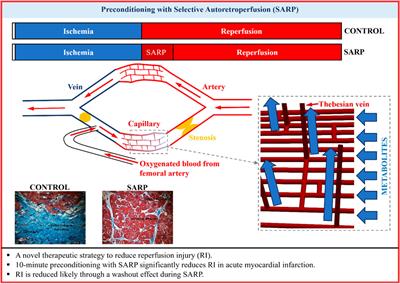 Preconditioning with selective autoretroperfusion: In vivo and in silico evidence of washout hypothesis